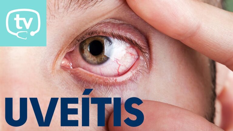 tipos de venas en los ojos