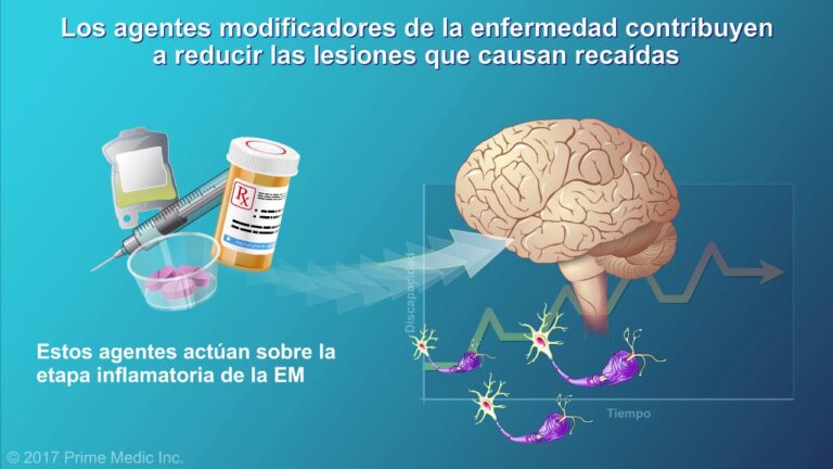 tratamiento para la esclerosis multiple