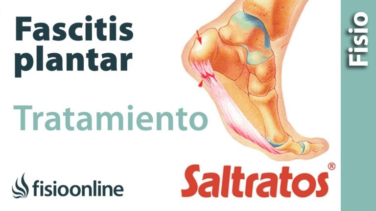 tratamiento para la fascitis plantar