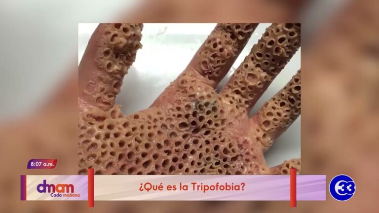 tripofobia en la piel es real