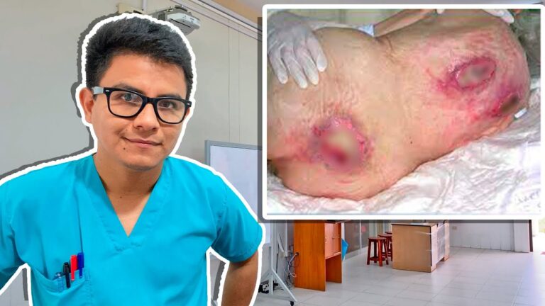 úlceras en la piel en personas mayores