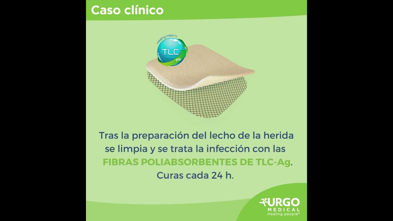 úlceras por presión grado 4