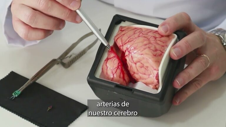 vida despues de un aneurisma cerebral